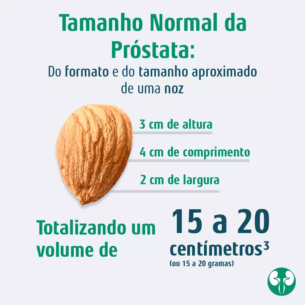Qual o tamanho normal da próstata? Dr. Paulo Maron