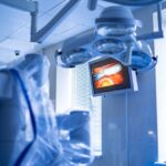 Ambiente cirúrgico moderno com monitor exibindo imagens internas, ilustrando tecnologias como laparoscopia e cirurgia robótica.
