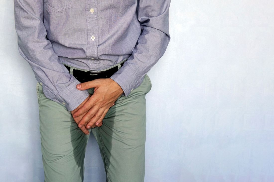 Homem com mãos na frente da calça que está molhada porque sofreu com um episódio de incontinência urinária.