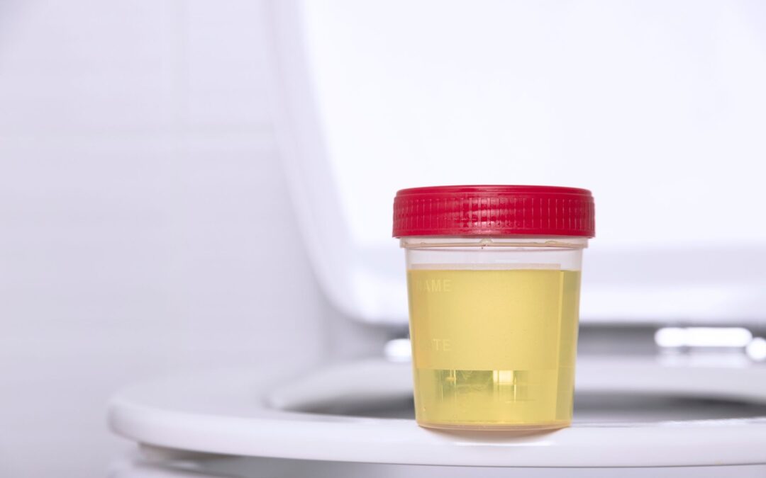 Sangue na urina: pode ser algo grave?