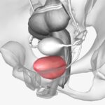 Ilustração anatômica mostra glândula prostática em destaque abaixo da bexiga, representando o volume normal da próstata aos 60 anos.