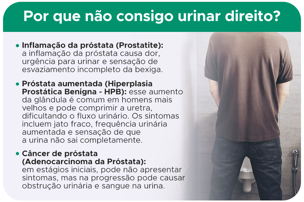 Por que não consigo urinar direito?
Inflamação da próstata (Prostatite): a inflamação da próstata causa dor, urgência para urinar e sensação de esvaziamento incompleto da bexiga.
Próstata aumentada (Hiperplasia Prostática Benigna - HPB): esse aumento da glândula é comum em homens mais velhos e pode comprimir a uretra, dificultando o fluxo urinário. Os sintomas incluem jato fraco, frequência urinária aumentada e sensação de que a urina não sai completamente.
Câncer de próstata (Adenocarcinoma da Próstata): em estágios iniciais, pode não apresentar sintomas, mas na progressão pode causar obstrução urinária e sangue na urina.