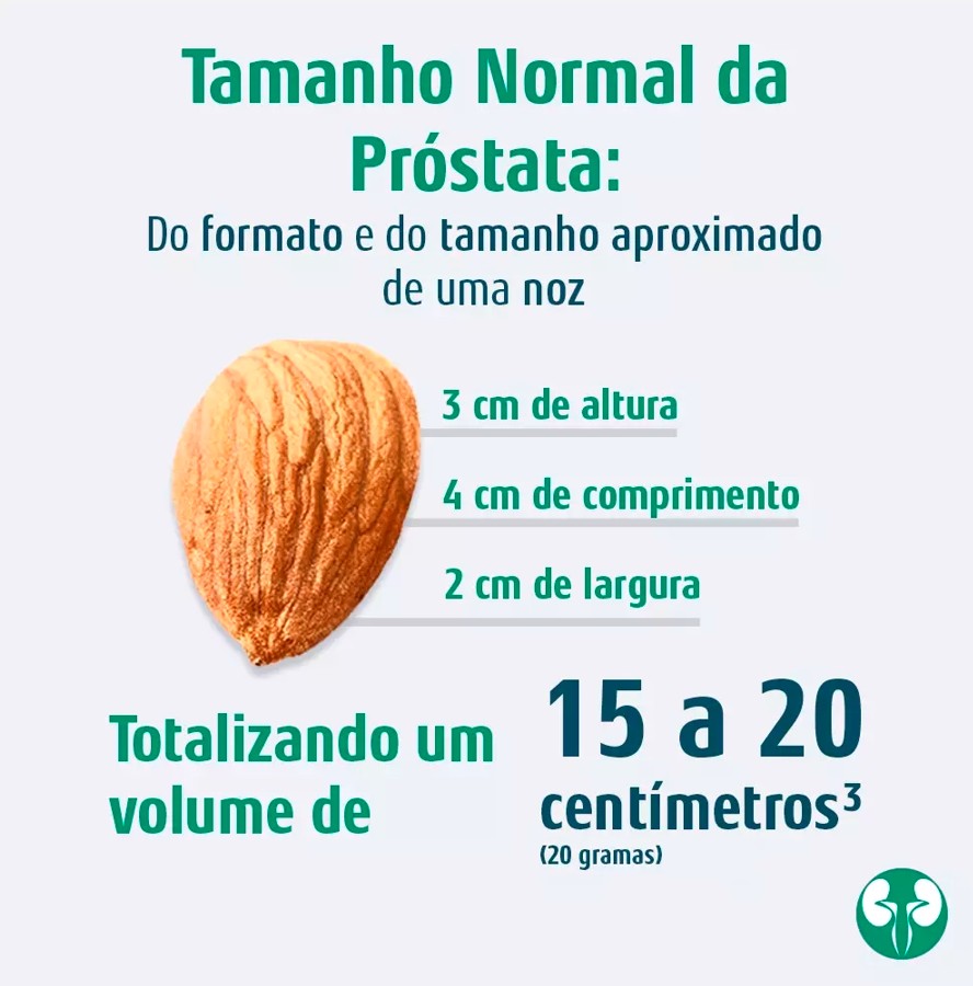 Qual o tamanho normal da próstata? Do formato e do tamanho aproximado de uma noz. 3 cm de altura; 4 cm de comprimento; 2 cm de largura. Totalizando um volume de 15 a 20 cm³ (20 gramas).