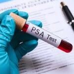 mão enluvada segurando um tubo de ensaio com sangue e o rótulo "PSA Test", sobre um documento médico e uma caneta. Este exame clínico é crucial para monitorar a saúde da próstata, com a relevância de identificar quando o PSA é preocupante e requer avaliação médica.