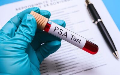 Quando o PSA é preocupante? Diferença entre aumento benigno e suspeita de câncer
