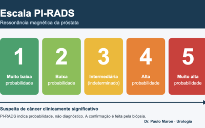 PI-RADS 3, 4 ou 5: o que significa o resultado da ressonância da próstata?