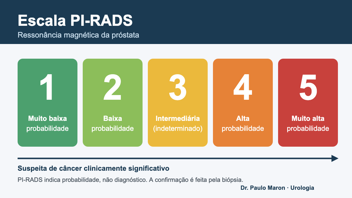 Escala PI-RADS de 1 a 5 na ressonância magnética da próstata