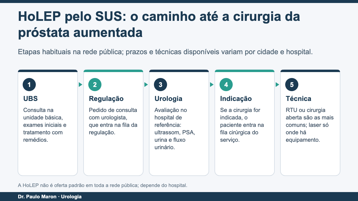 HoLEP pelo SUS: etapas do caminho na rede pública até a cirurgia da próstata aumentada