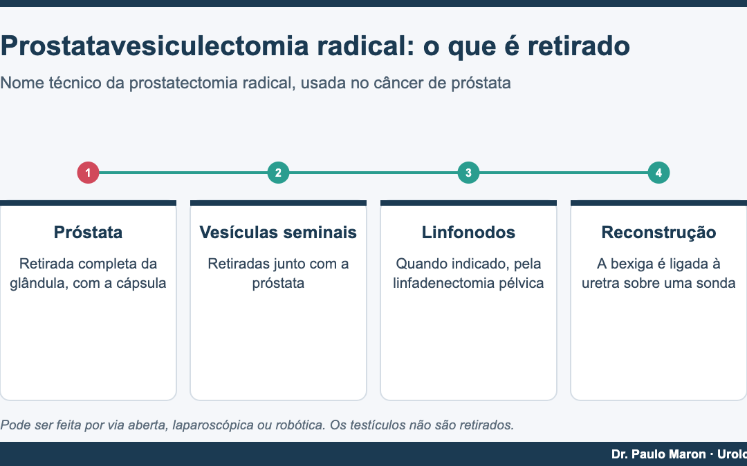 Prostatavesiculectomia radical: o que significa no pedido médico e como é a cirurgia
