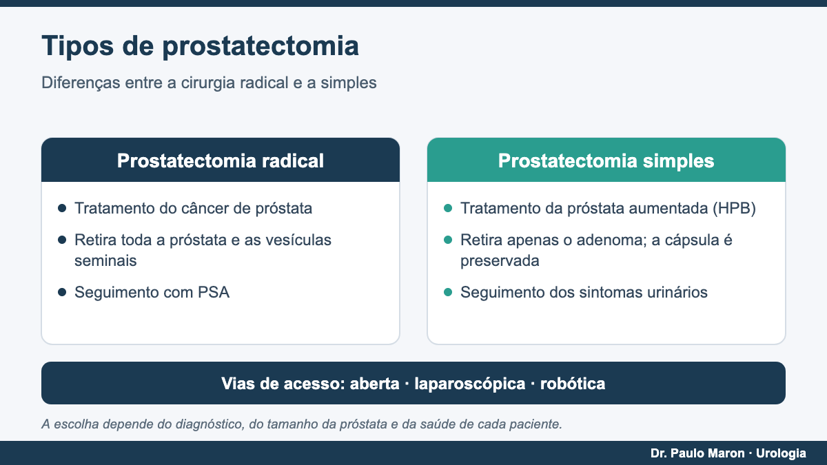 Tipos de prostatectomia: radical e simples, com vias aberta, laparoscópica e robótica